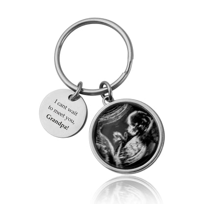 Personalized Ultrasound Keychain, Baby Scan Sonogram Picture Photo Keyring, First Time Daddy Mummy To Be Expecting Custom Gift, C.1