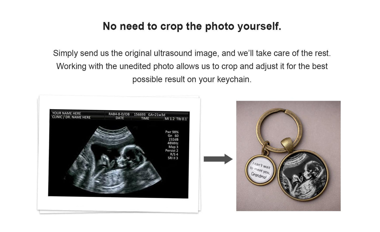Personalized Ultrasound Photo Keychain, Pregnancy Gifts, Custom Daddy Keychain, Ultrasound Gifts, Mothers Day Gift, Father, New Dad, C.1