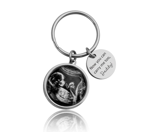 Personalized Baby Ultrasound Keychain, Baby Scan Sonogram Picture Photo Keyring, First Time Father Daddy To Be Gift Pregnancy Expecting, C.1