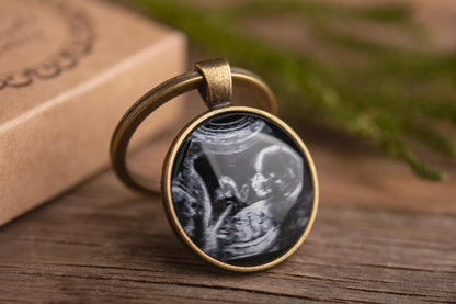 Custom Ultrasound Photo Keychain, Sonogram or Ultrasound Picture Gift, Pregnancy Gift, Expecting Gift, Daddy To Be Gift, Mommy To Be, C.1