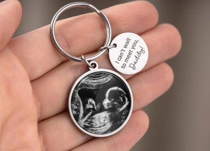 Baby Ultrasound Pregnancy Gifts for New Daddy to Be Keychain with Custom Ultrasound Scan Picture Personalized Keyring for Expecting Dad C.1